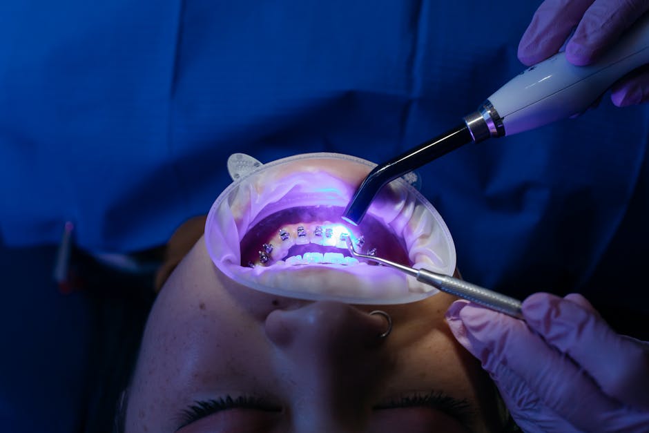 Teeth whitening procedure - Cosmetic Dentistry