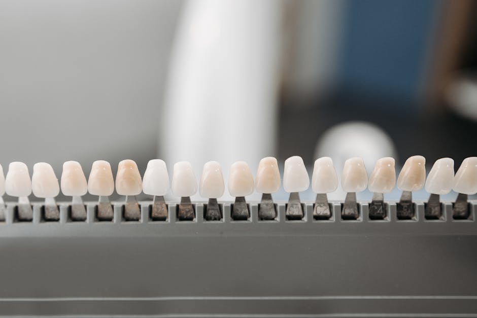 Close-up of dental veneers - Cosmetic Dentistry