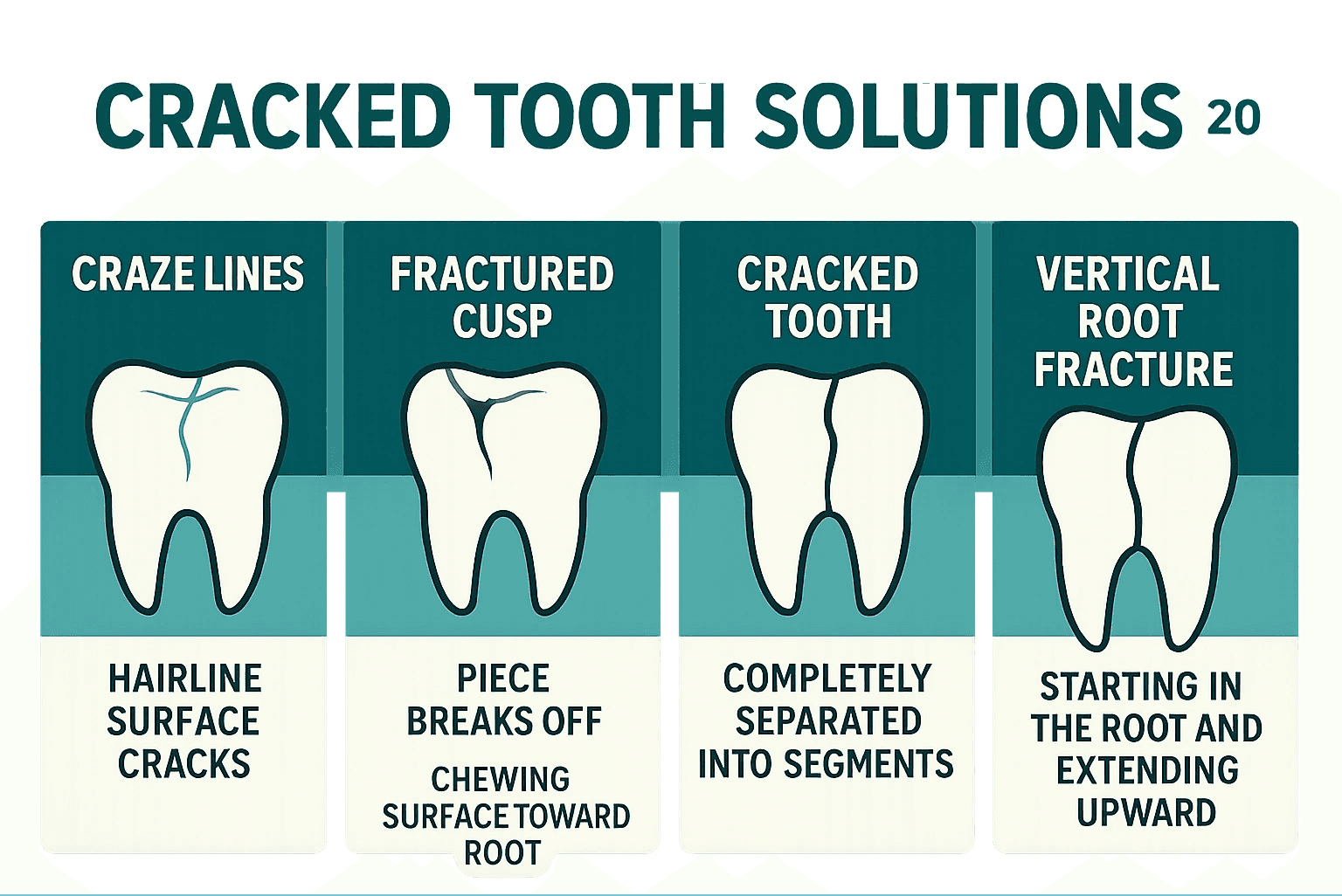 Infographic showing the five main types of tooth cracks: craze lines as hairline surface cracks, fractured cusp where a piece breaks off, cracked tooth extending from chewing surface toward root, split tooth completely separated into segments, and vertical root fracture starting in the root and extending upward - Cracked tooth solutions infographic