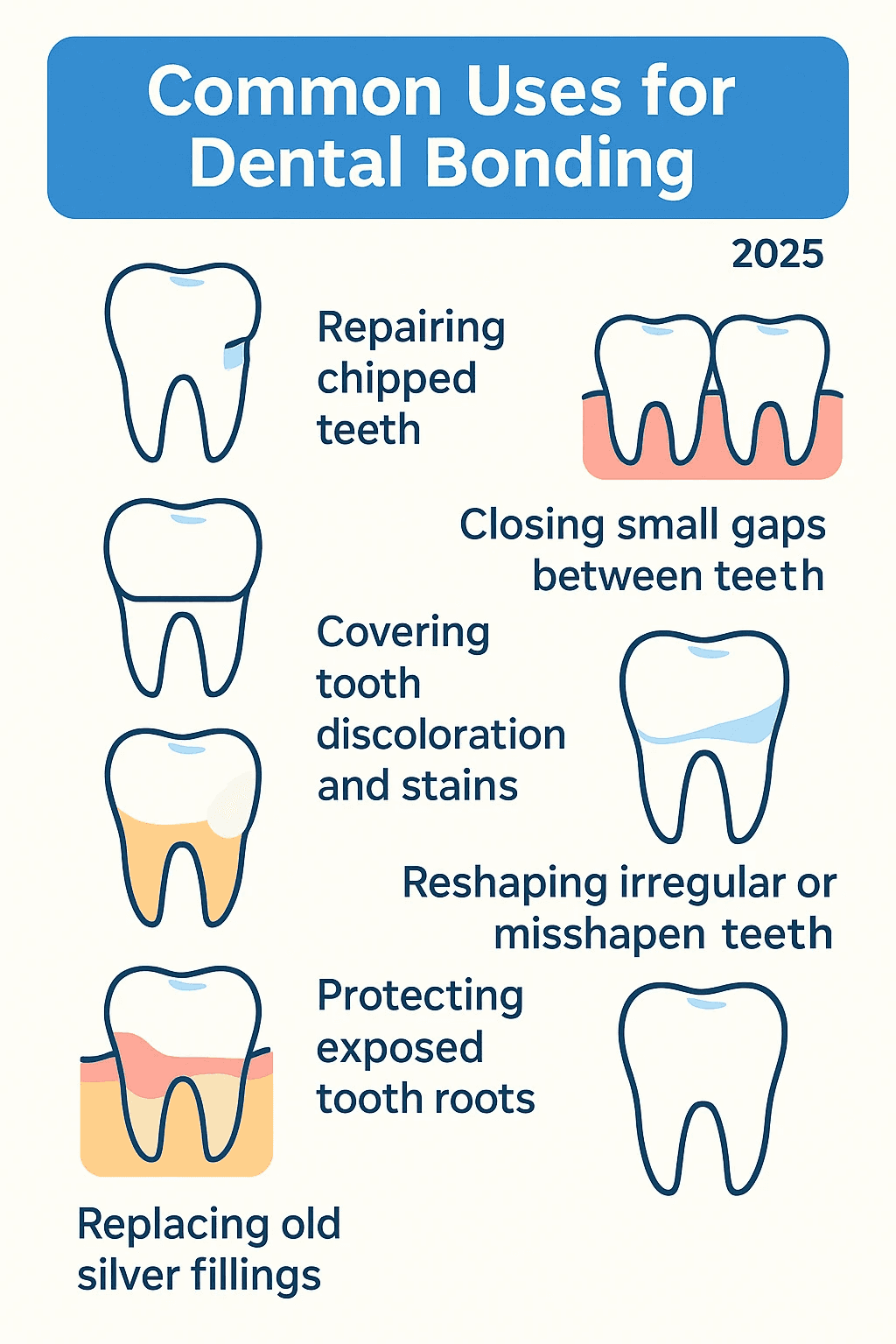Infographic showing common uses for dental bonding including repairing chipped teeth, closing small gaps between teeth, covering tooth discoloration and stains, reshaping irregular or misshapen teeth, protecting exposed tooth roots from gum recession, and replacing old silver amalgam fillings with tooth-colored alternatives - cost of dental bonding without insurance infographic 