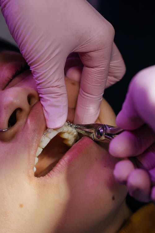 IMAGE of a dental hygienist working with a patient
